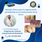 Manejo clínico para la regeneración periodontal en la involucración de la furca. $USD